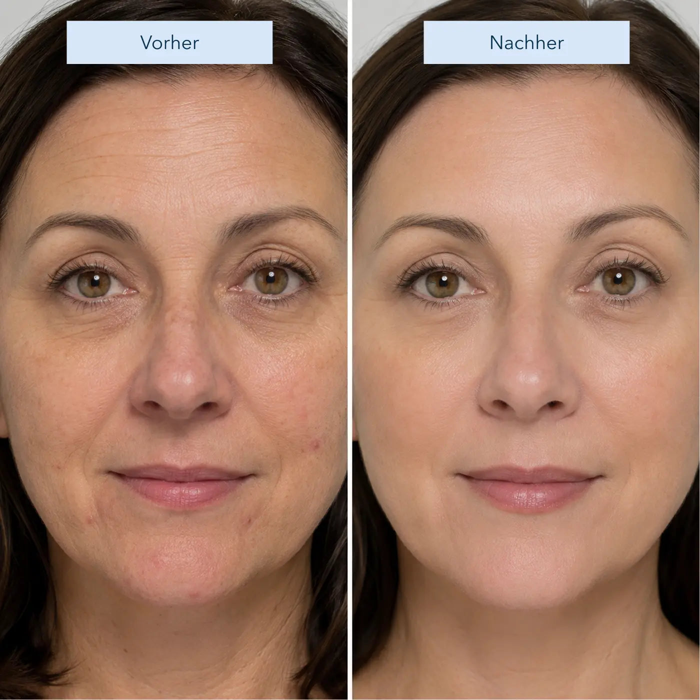 Peptide Anti-Aging Serum
