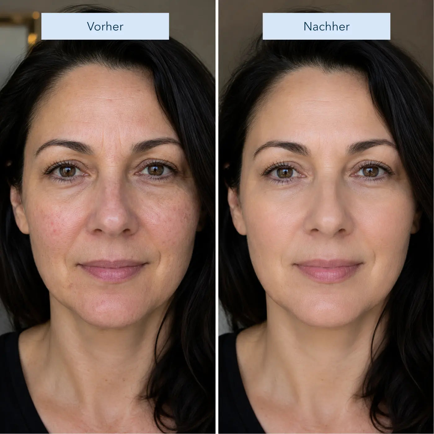 Peptide Anti-Aging Serum