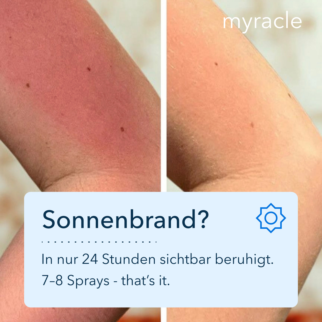 myracle - Daily Magic Skin Spray