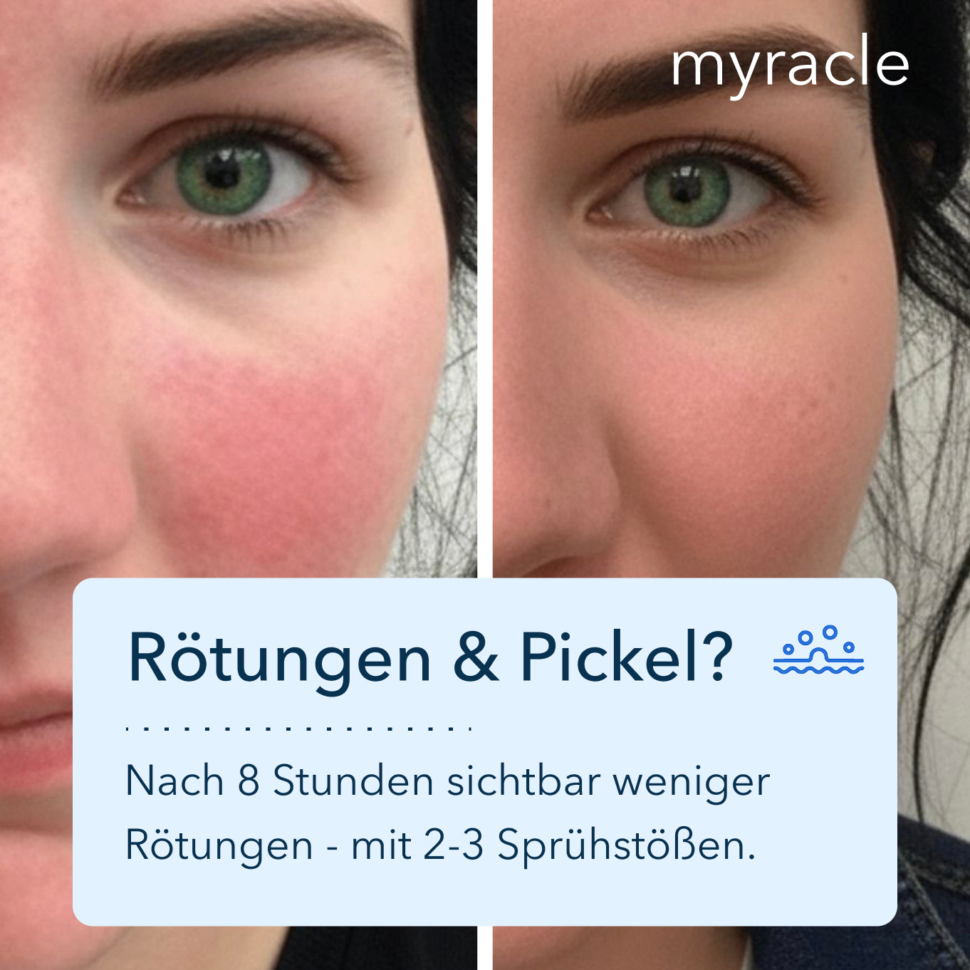 myracle - Daily Magic Skin Spray