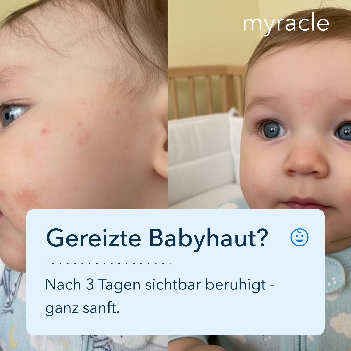 myracle - Daily Magic Skin Spray