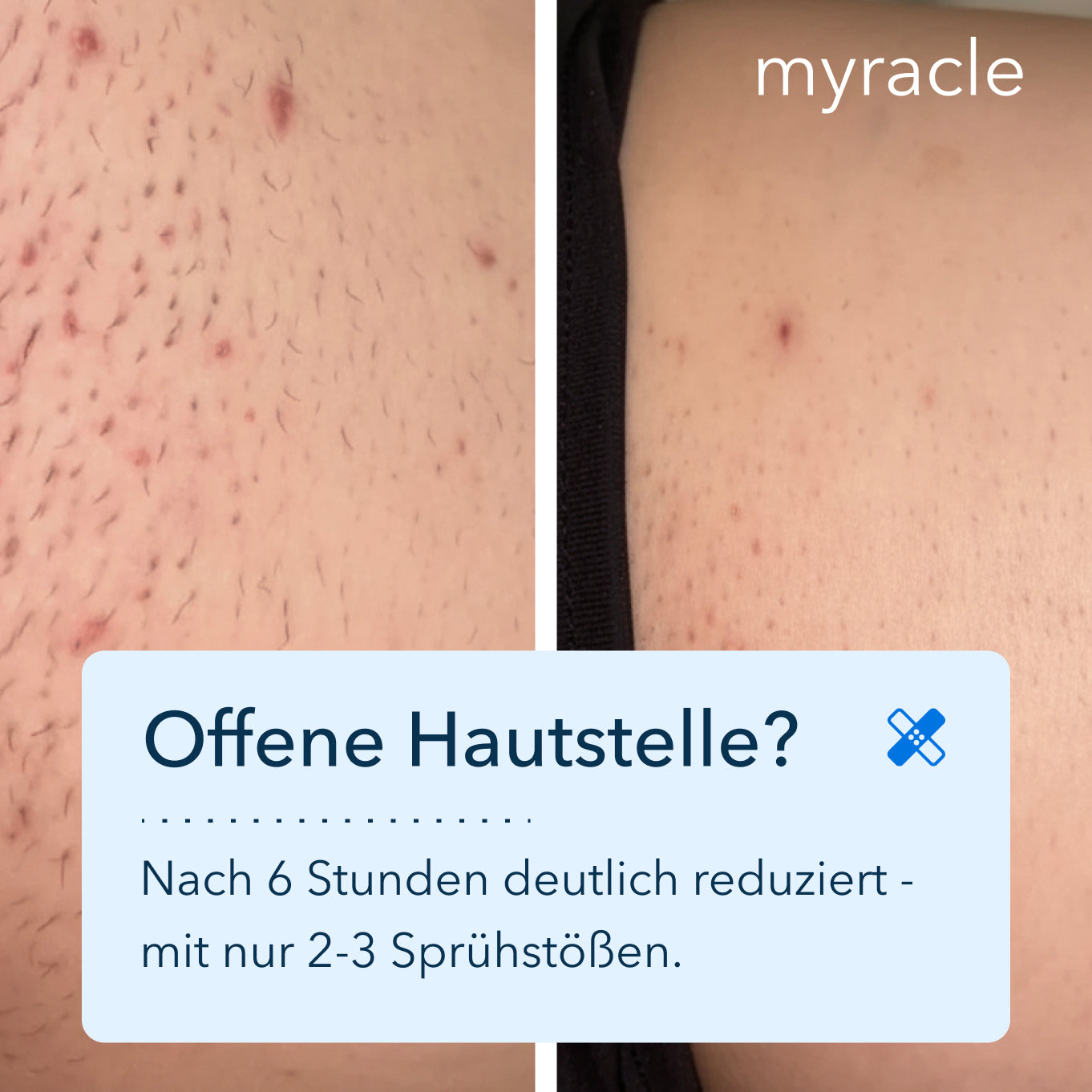 myracle - Daily Magic Skin Spray