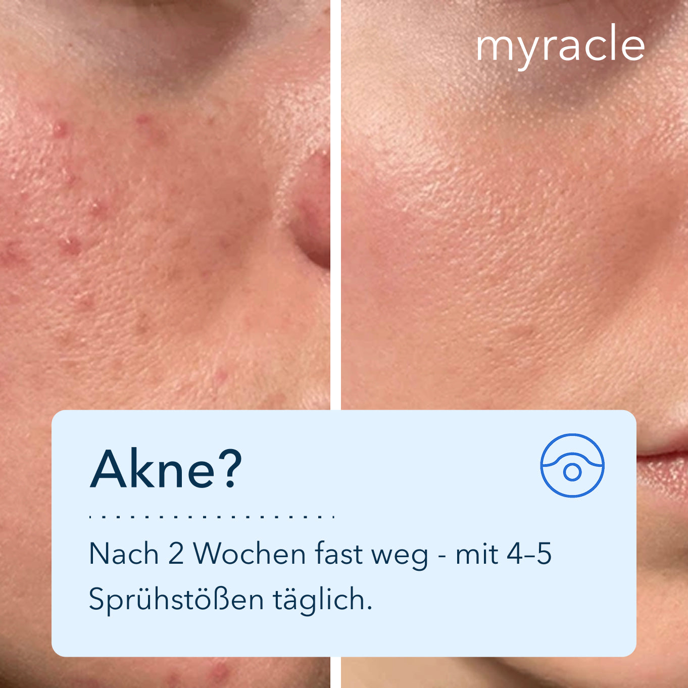 myracle - Daily Magic Skin Spray